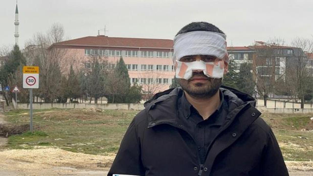 Okulda korku dolu anlar! Eskişehir'de &ouml;ğretmen meslektaşının y&uuml;z&uuml;n&uuml; yaktı iddiası