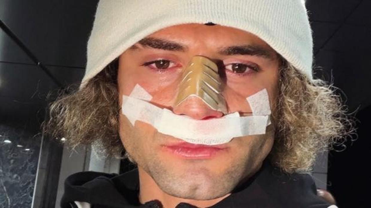 2. Lig'in gol kralının burnu kırıldı! Maçı bu şekilde tamamladı