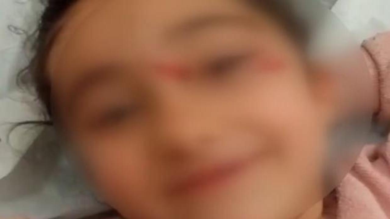 Yer: Ey&uuml;psultan! Okul d&ouml;n&uuml;ş&uuml; başıboş k&ouml;pek dehşeti: 6 yaşındaki &ccedil;ocuk hastanelik oldu