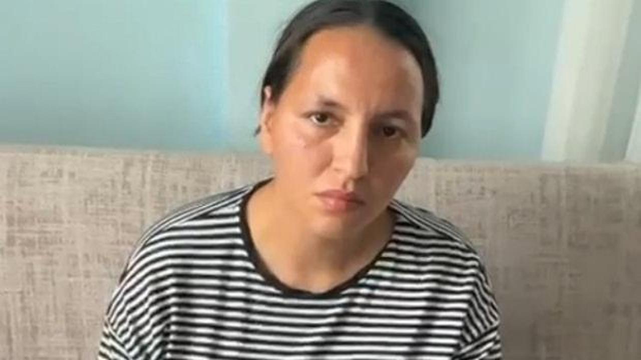 17 bı&ccedil;ak darbesi aldı, &ouml;l&uuml; numarasıyla kurtuldu!