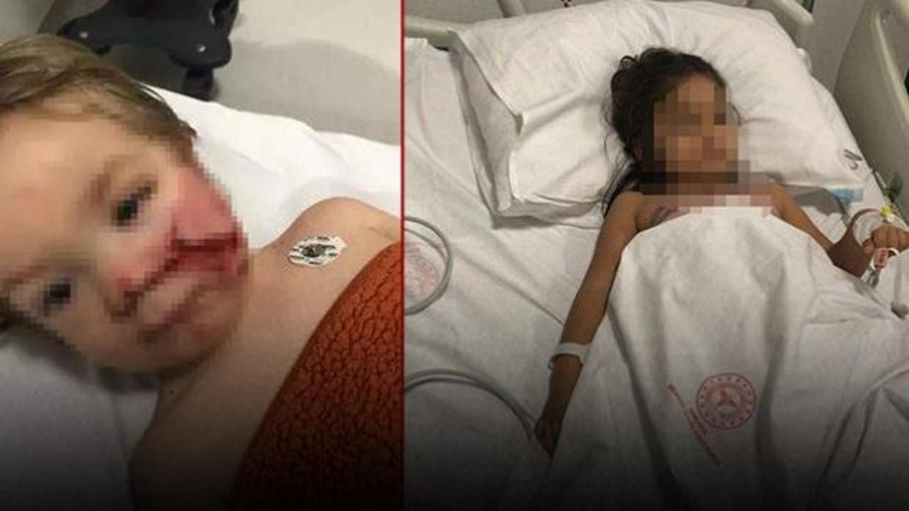 Ankara'da 2 kardeş pitbull saldırısına uğramıştı! Yeni gelişme 