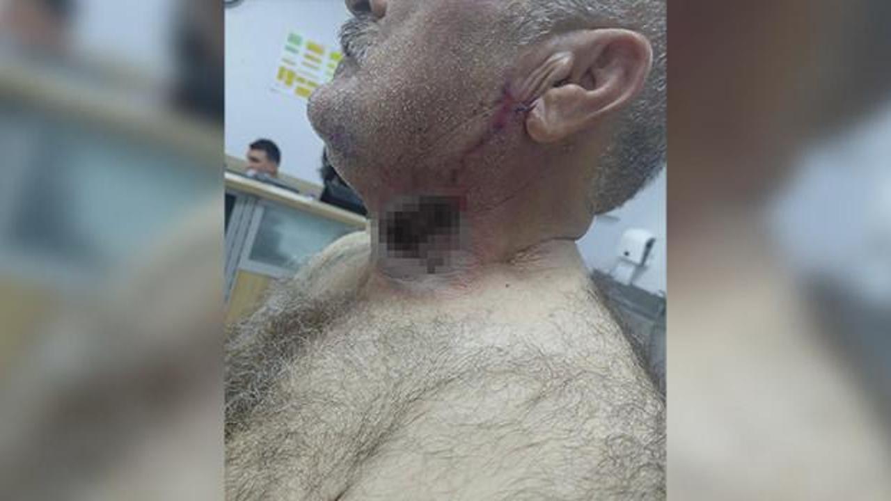 Yere d&uuml;ş&uuml;rd&uuml;, &uuml;st&uuml;nde tepindi: At, sahibini boğazından ısırdı!