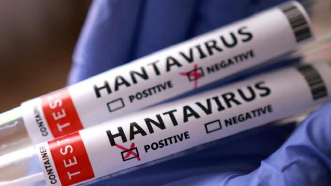 İngiltere'de yeni hantavir&uuml;s vakası!