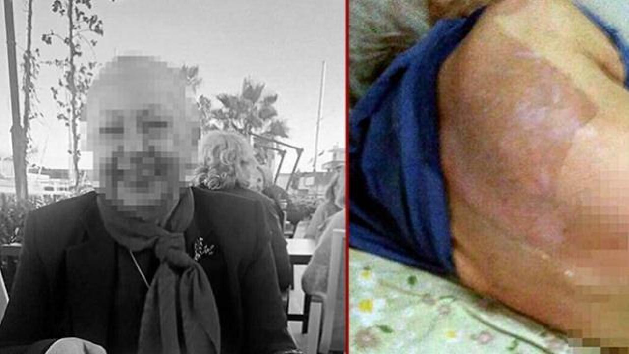 Huzurevinde banyo sonrası hastanelik olmuştu: &Ouml;l&uuml;m davasında doktora 6 taksitli ceza 