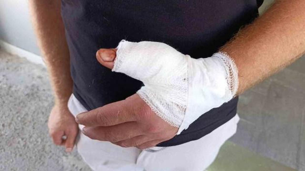 Bayramın ikinci g&uuml;n&uuml;nde 869 kişi hastanelere başvurdu