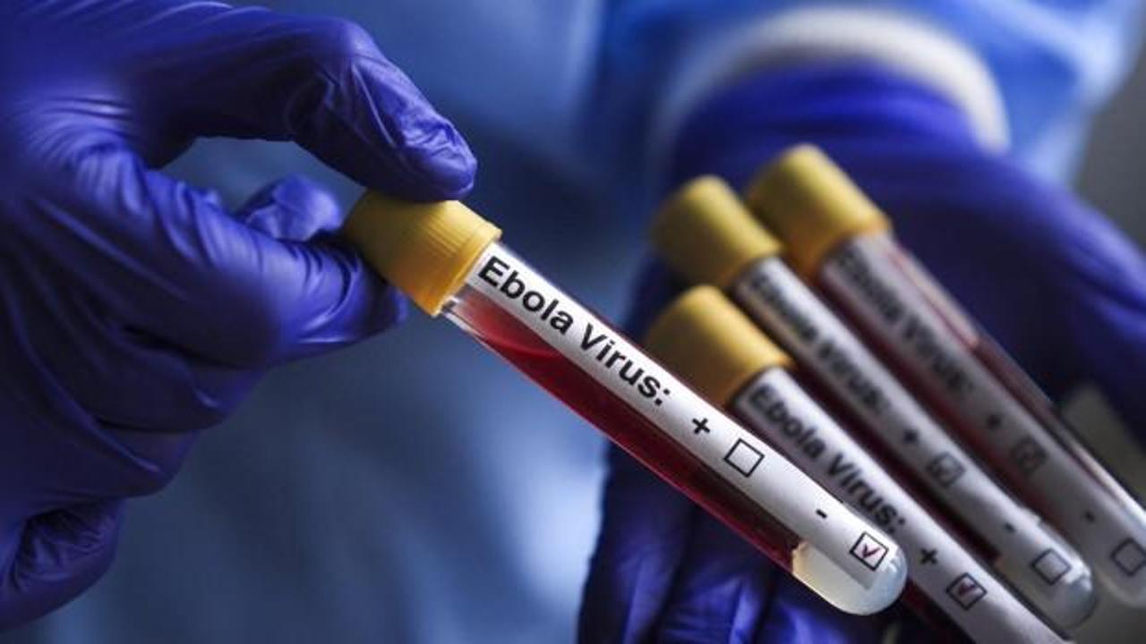 İsrail'de Ebola şüphesiyle bir kişinin hastanede karantinaya alınması