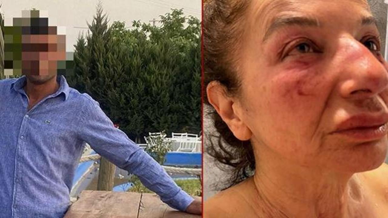 Yalanla ayağına &ccedil;ağırdı &ouml;ld&uuml;resiye d&ouml;vd&uuml;! Saldırgan belediye &ccedil;alışanı &ccedil;ıktı