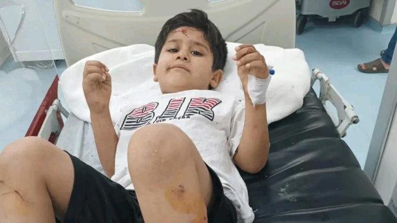 Şanlıurfa'da başıboş köpek saldırısı sonrası inceleme başlatıldı