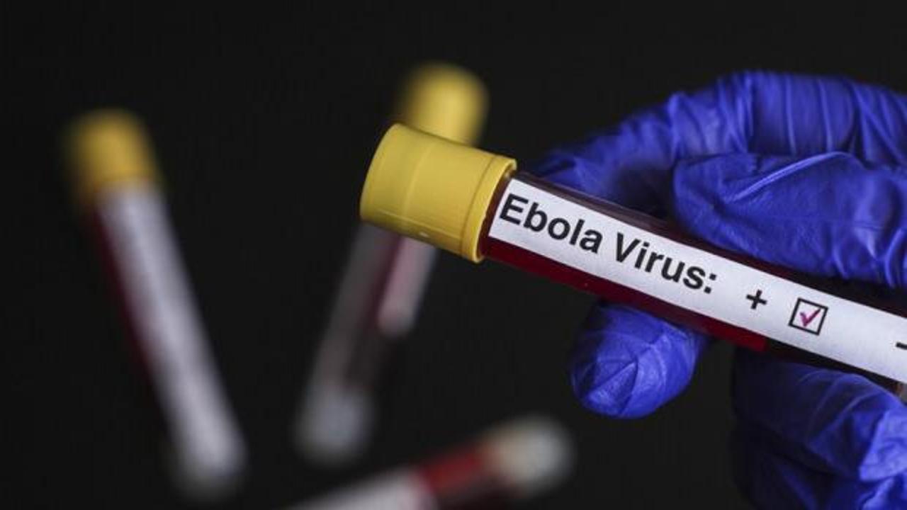 Ebola alarmında "T&uuml;rkiye" sorusu: Şu anda bir risk s&ouml;z konusu değil!
