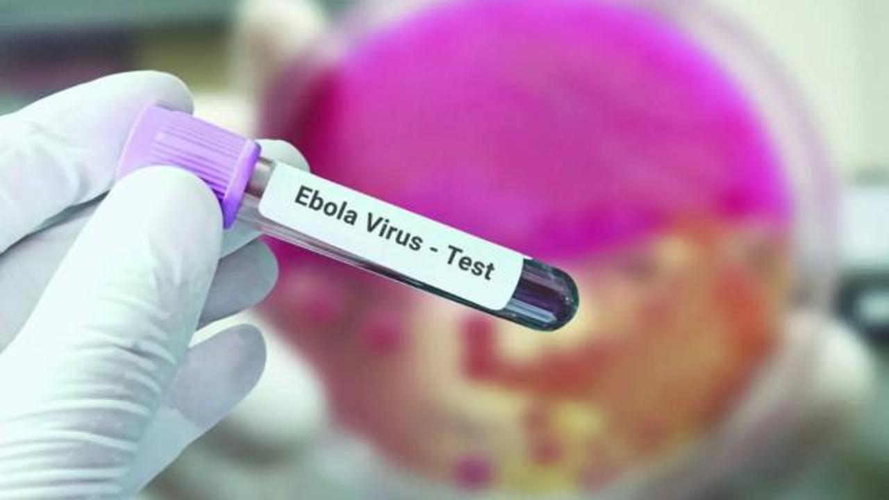 Fransa'da ebola vakası g&ouml;r&uuml;ld&uuml;