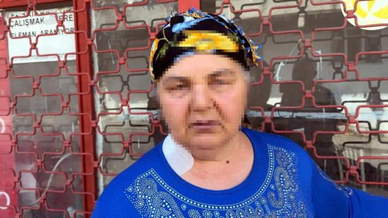 26 yıl &ouml;nce boşandığı adam boynundan bı&ccedil;akladı