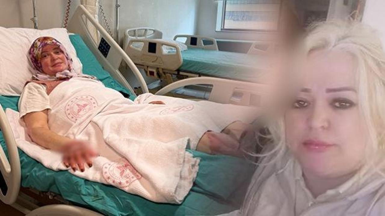 V&uuml;cudunun y&uuml;zde 70'i yanan kadın uyardı: Satın alırken dikkat etsinler 