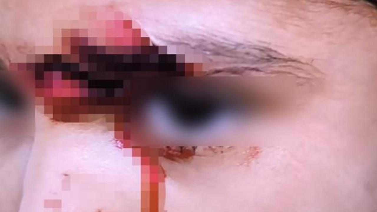 Şanlıurfa'da sokak köpeklerinin saldırdığı 8 yaşındaki Evin Bayo'nun tedavi altında olduğu hastane odası.