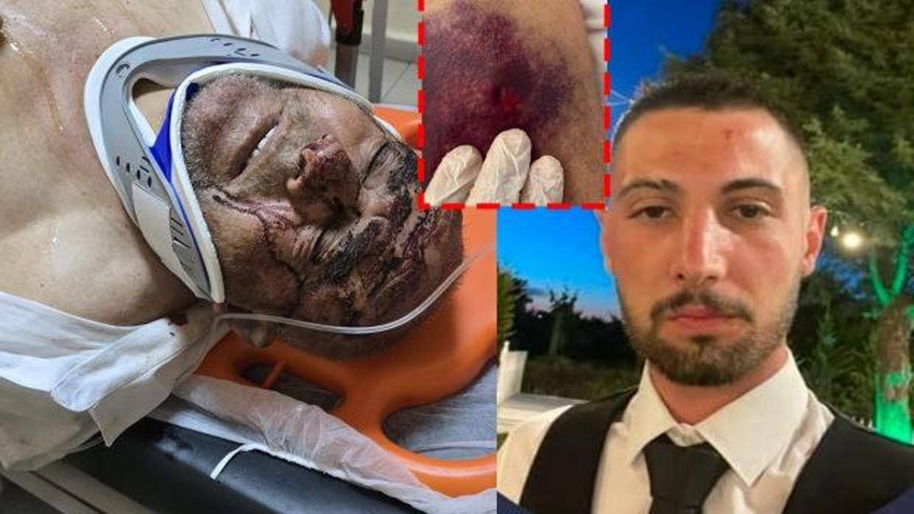 &Ccedil;anakkale&rsquo;de akılalmaz olay! 150 bardak &ccedil;ay i&ccedil;in &ouml;ld&uuml;resiye d&ouml;v&uuml;ld&uuml;