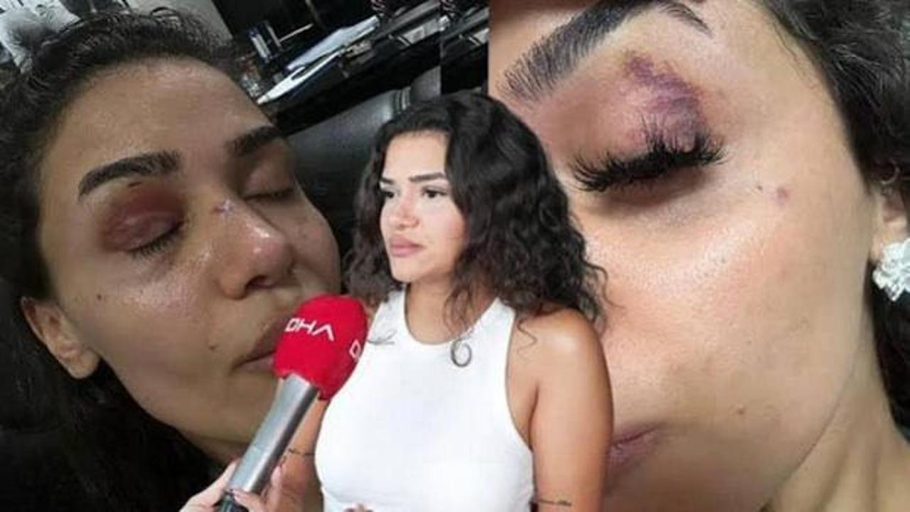 Ebru hemşire: "&Ouml;lmeden &ouml;nce sesimi duyun" 