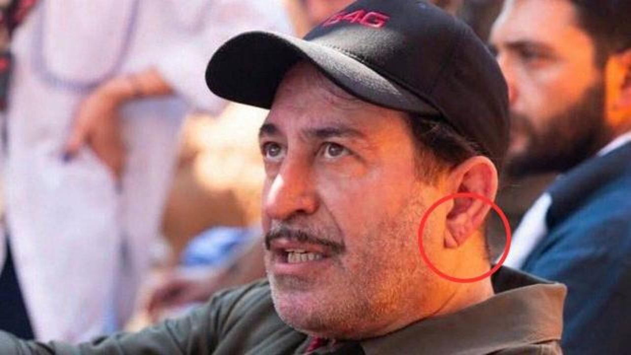 Cem Yılmaz'ın rahatsızlığı sonrası g&uuml;ndem oldu: Kalp krizinin habercisi mi?