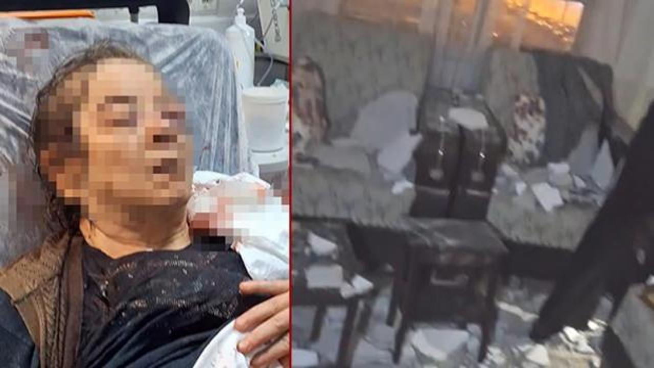 Kayseri'de inanması g&uuml;&ccedil; olay! Evinin salonunda otururken kan revan i&ccedil;inde kaldı