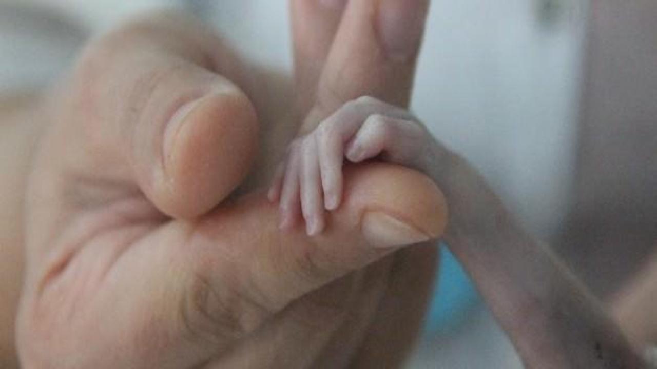 500 gram dünyaya gelen bebek hayata tutundu
