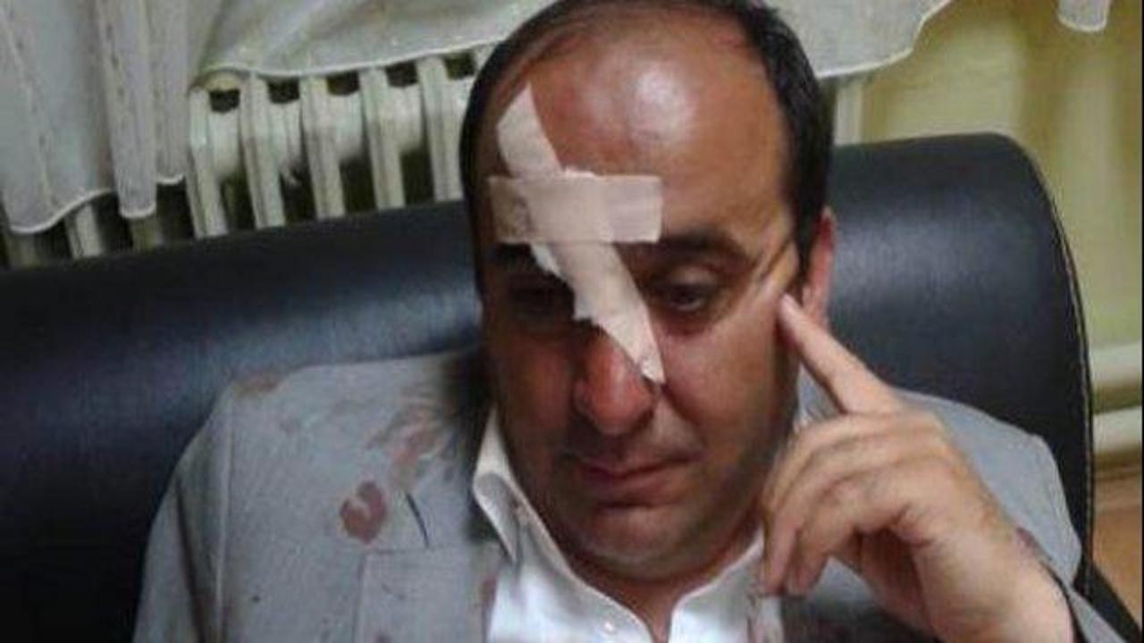 AK Partili Başkan saldırıya uğradı
