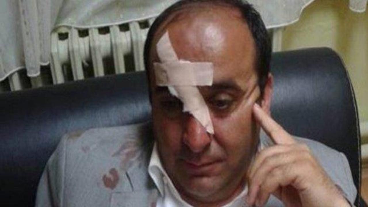 AK Partili Belediye Başkanını &ouml;ld&uuml;r&uuml;yorlardı