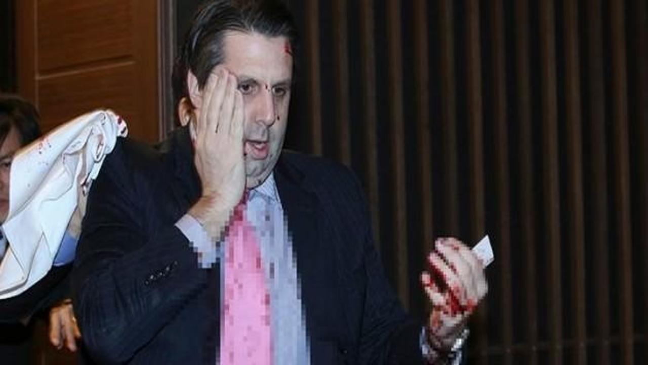 Amerikalı el&ccedil;i Mark Lippert taburcu edildi