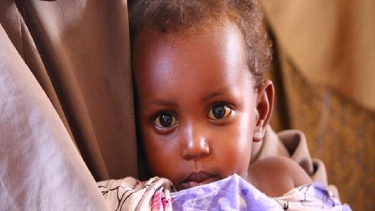AB'den Somali'ye 10 milyon avro insani yardım