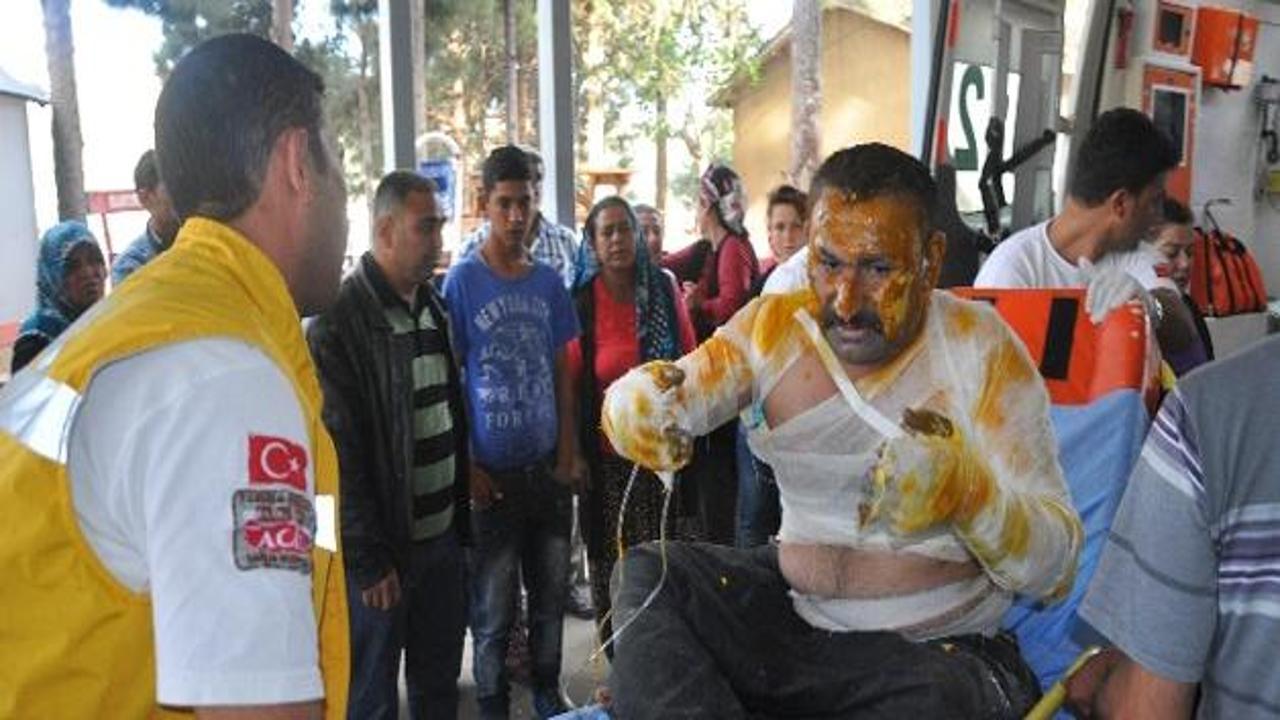 Boya deposunda yangın: 2 iş&ccedil;i ağır yaralı