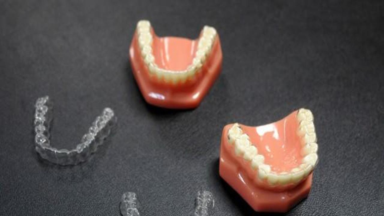 Diş plakları çene kaymasına neden oluyor