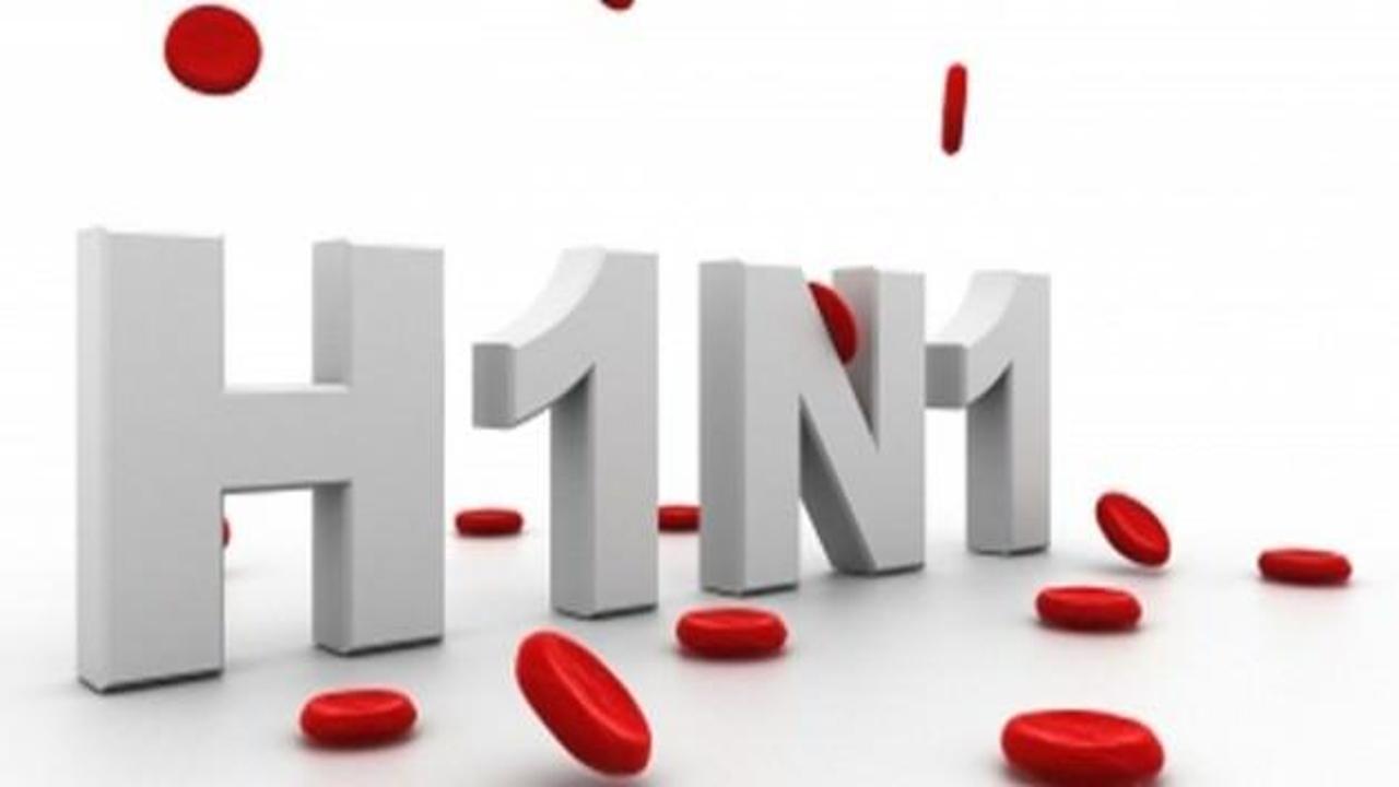 Domuz gribi olan hastanın durumu ağır