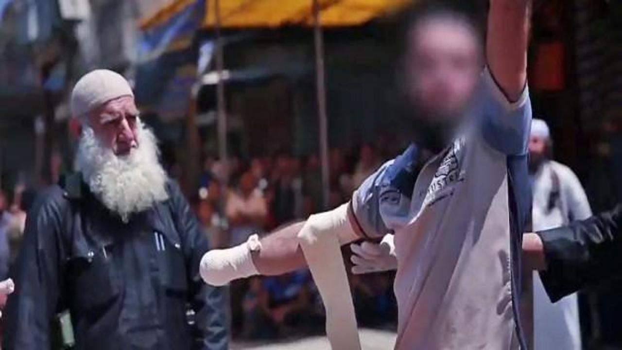 Eli kesildi 'Yaşasın IŞİD' diye bağırdı