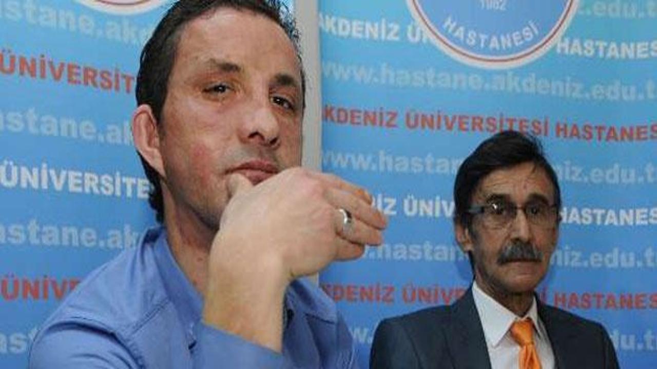 İlk yüz nakli 2 yaşında!