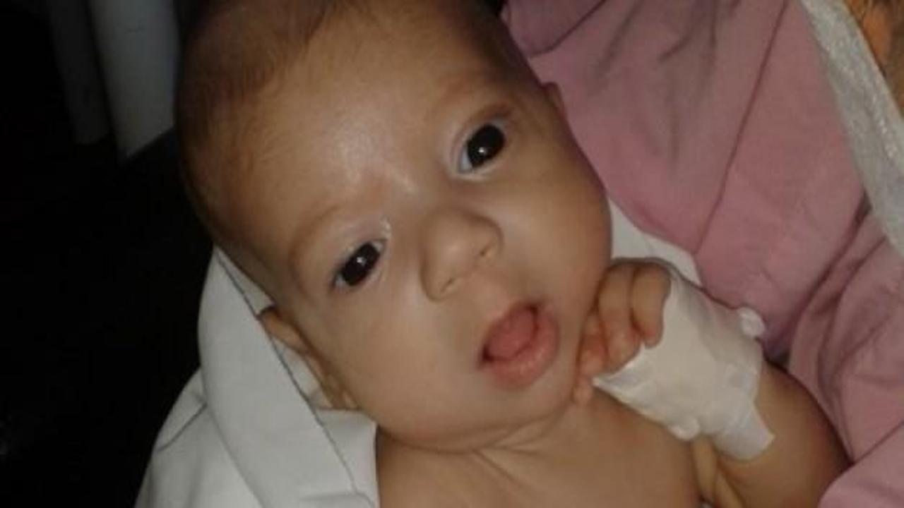 İzmir'de Berk bebeğe nakil heyecanı