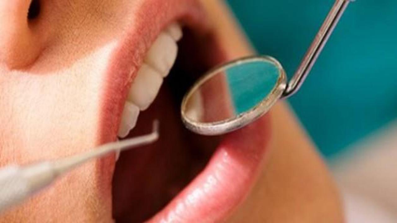 Kanser tedavisinden önce diş tedavisi
