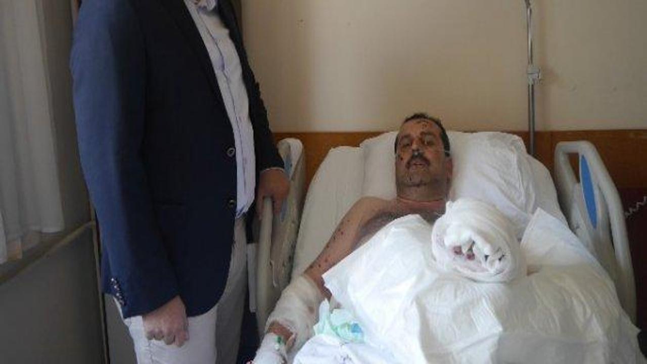 Ramazan topu elinde patladı