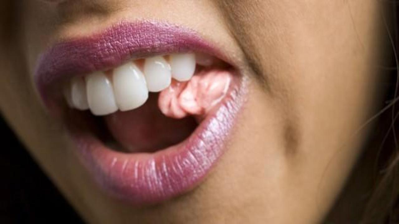 Sakız dişleriniz için yararlı mı zararlı mı?