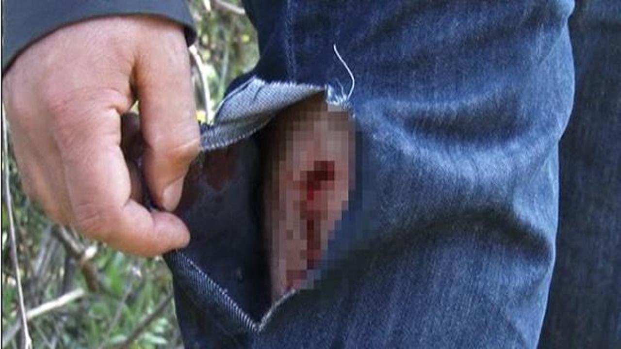 Şişli'nin g&ouml;beğinde 3 k&ouml;pek baba kıza saldırdı