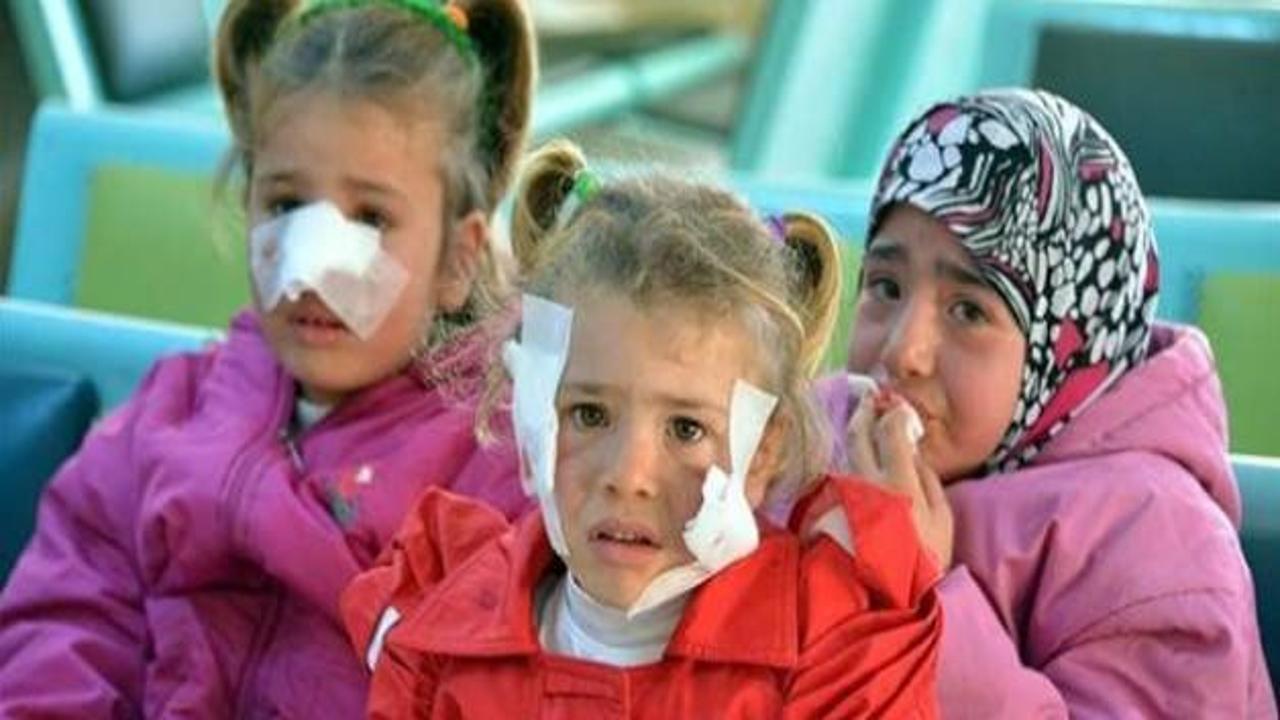 Suriyeli çocuklardaki şark çıbanı korkuttu