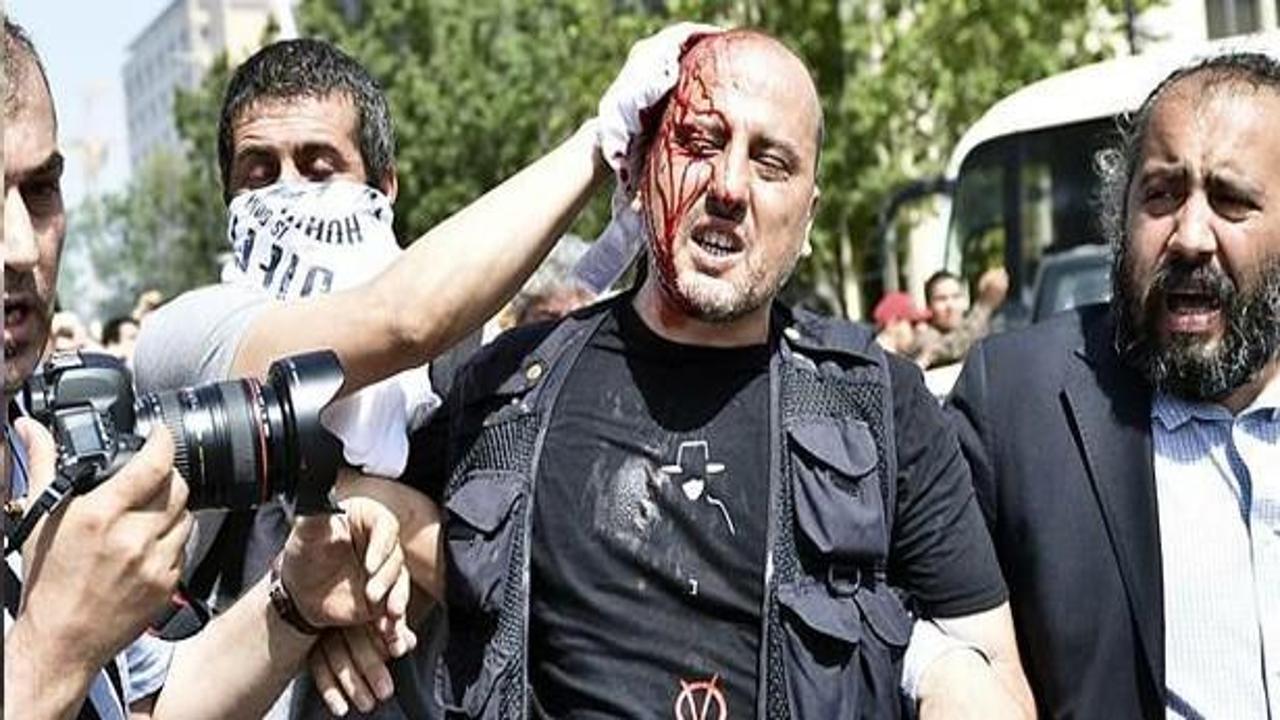 Taksim'de Ahmet Şık da yaralandı