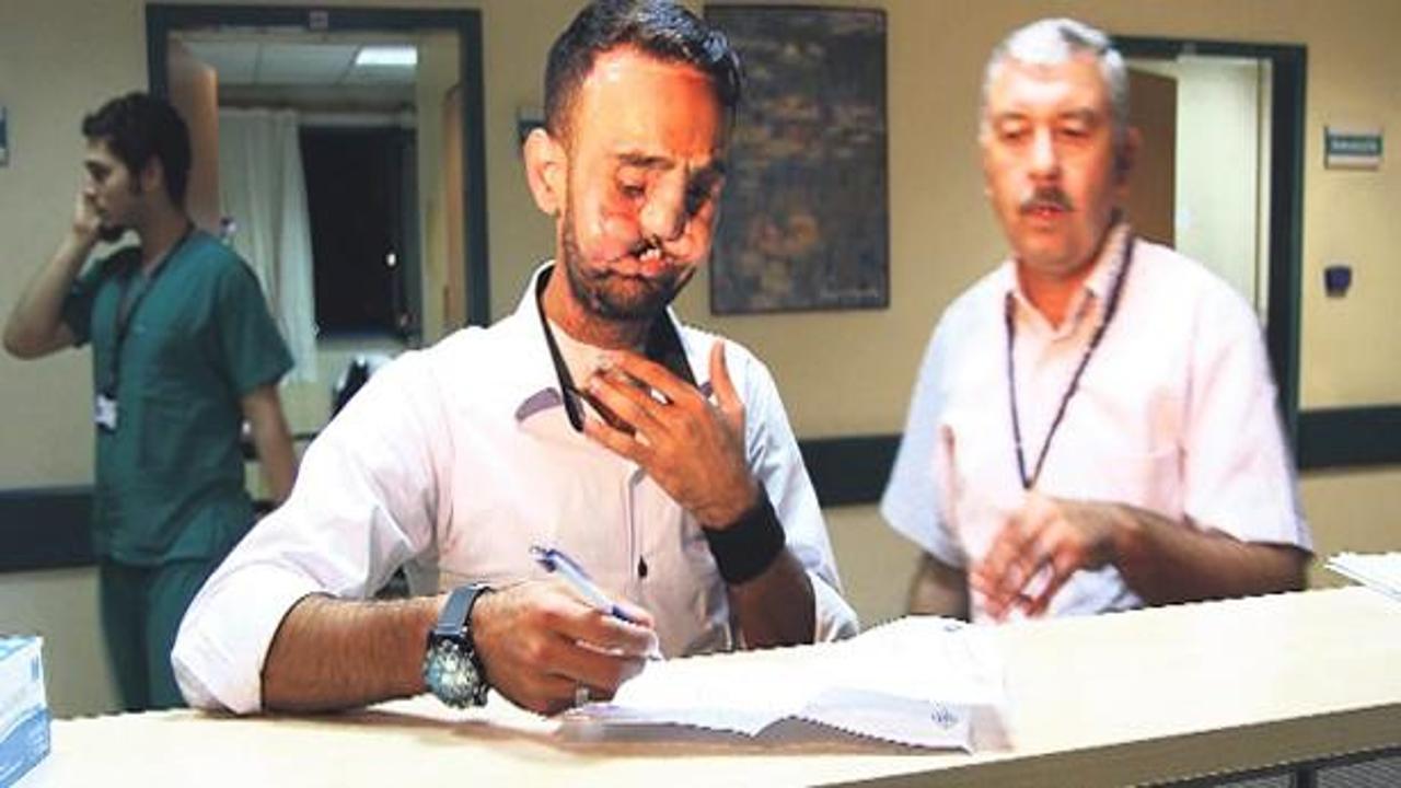 Yüz nakli olan Recep Sert uyandırıldı