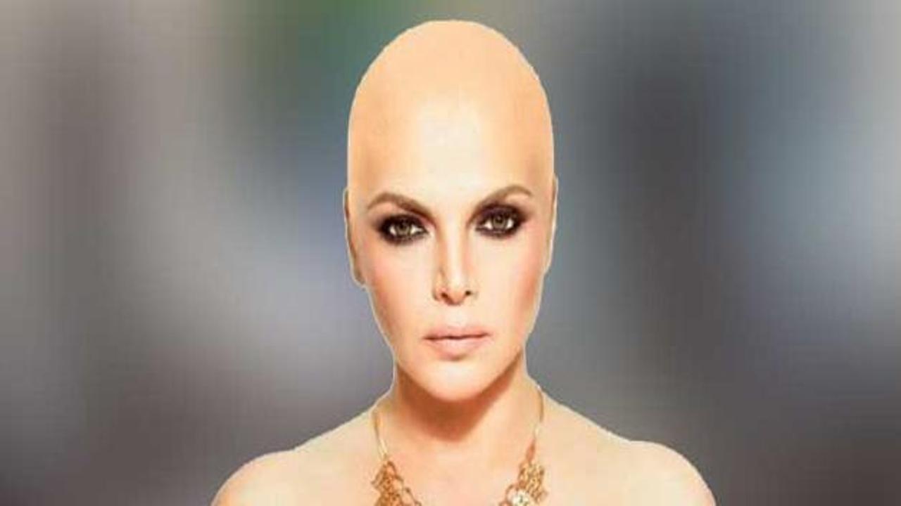 &Uuml;nl&uuml; sanat&ccedil;ı 33 yıl sonra yeniden kanser