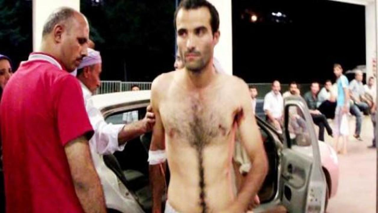Urfa'da iki aile arasında kavga: 6 yaralı
