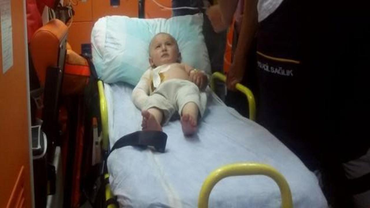 Üzerine kaynar su dökülen çocuk yaralandı