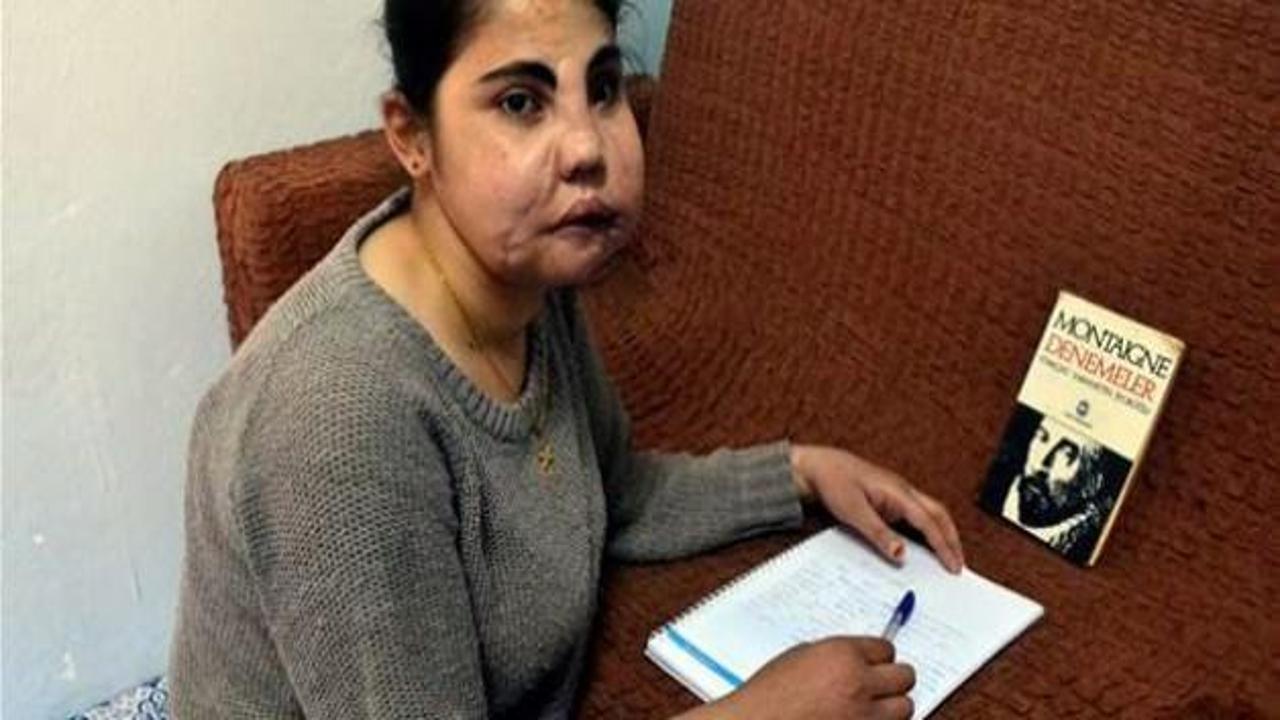 Yüz nakli yapılan ilk kadın hayatını yazdı
