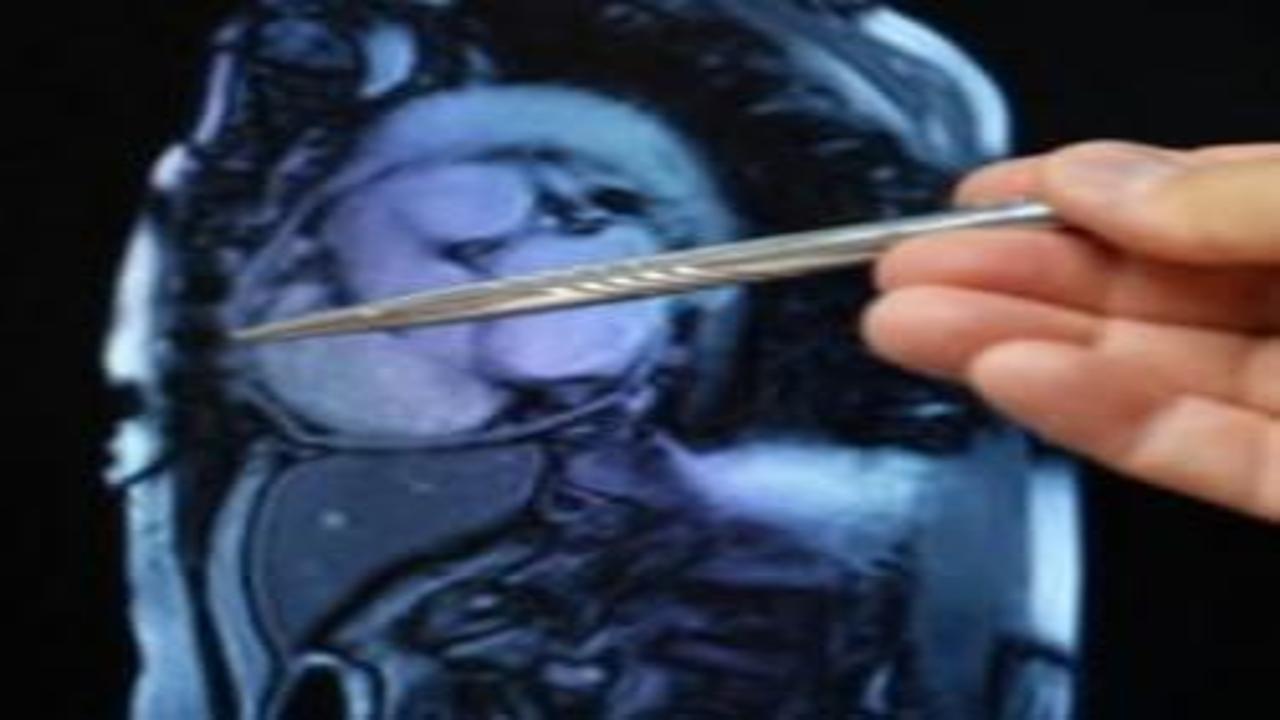 Yıllarca yanlış tedavi gördü, kalbi taşlaştı! Gerçek sorun ortaya çıktı, sağlığına kavuştu
