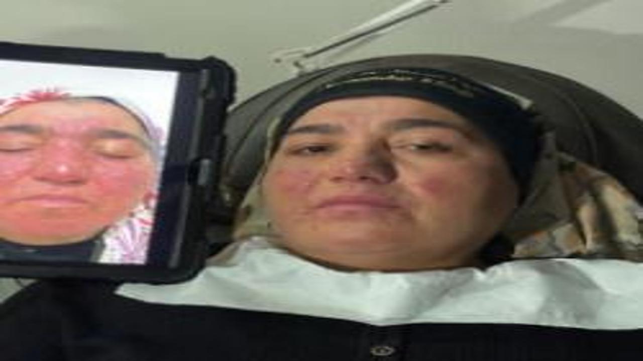 Hastalığı nedeniyle yıllarca evden çıkamayan kadın: Oğlumun düğününe gidemedim