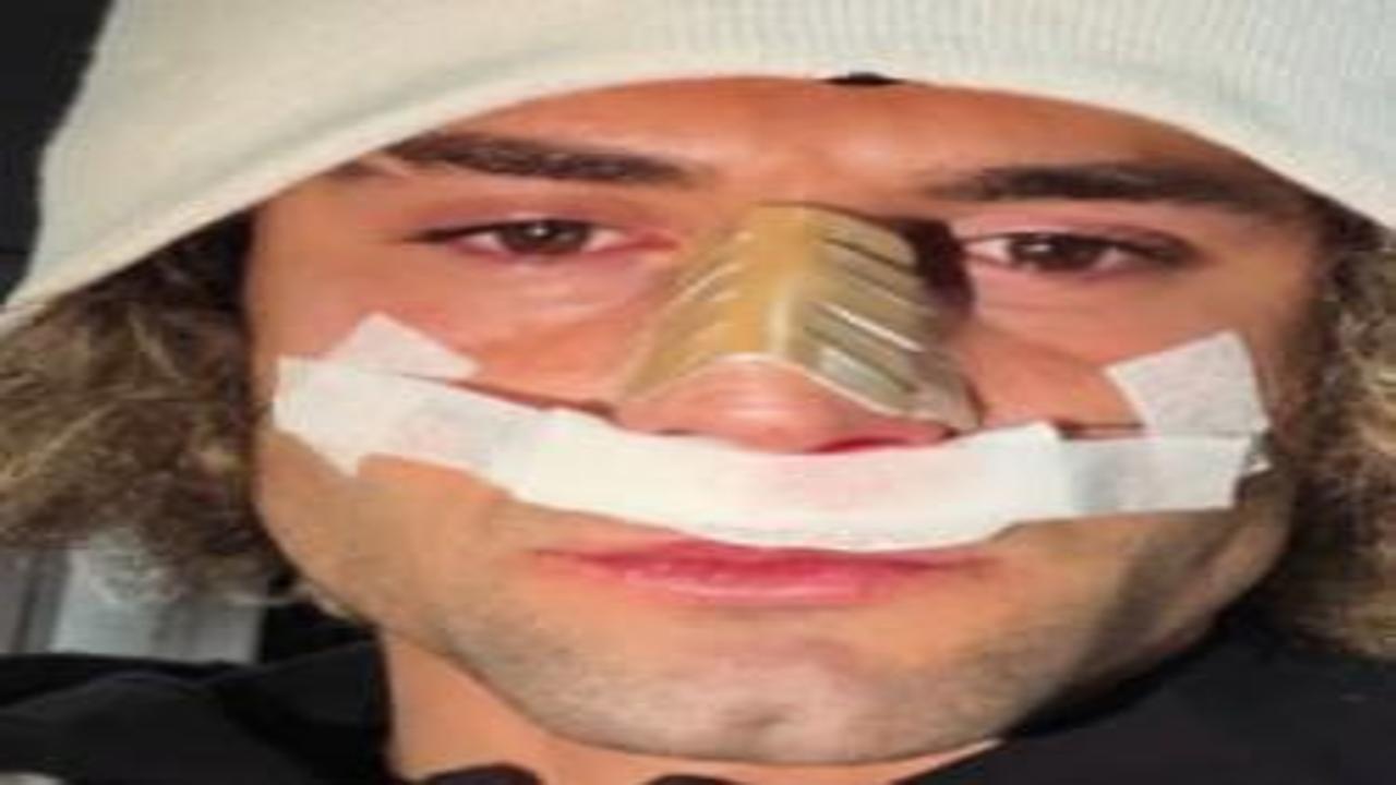 2. Lig'in gol kralının burnu kırıldı! Maçı bu şekilde tamamladı