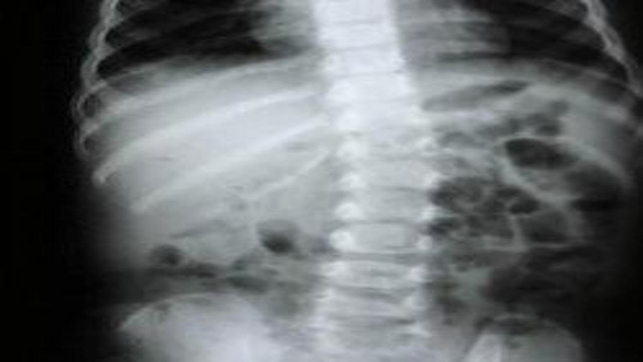 Omurga sağlığı için nelere dikkat edilmeli? Uzman isim açıkladı