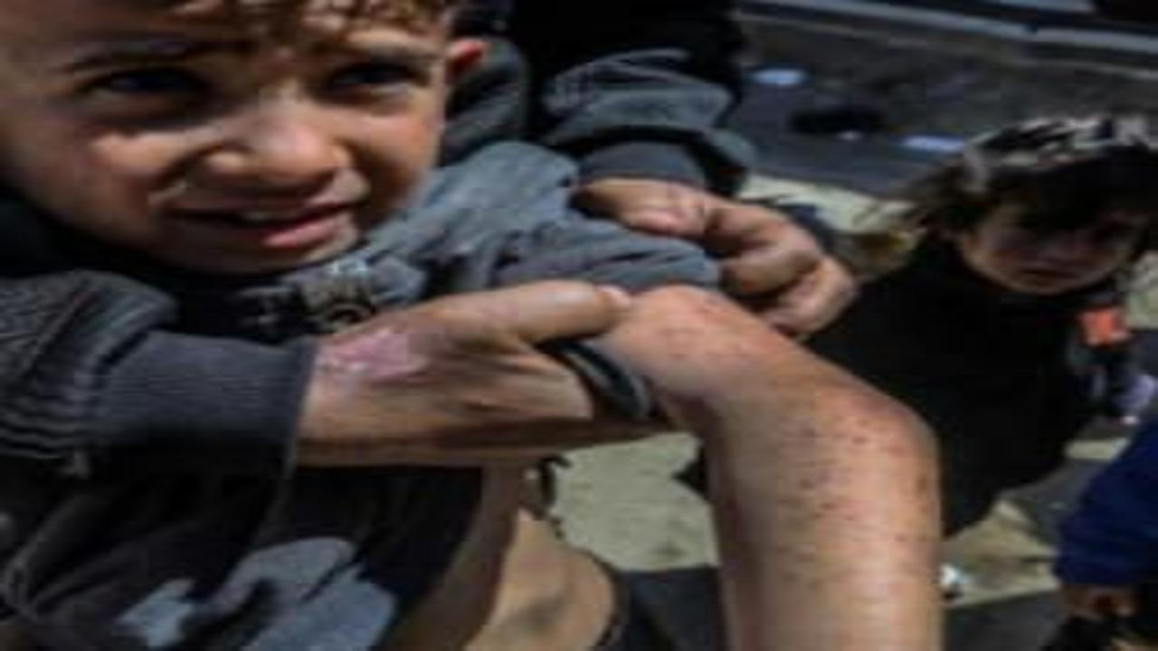 Gazze'de salgın uyarısı: Sağlık bakanlığından DSÖ'ye çağrı