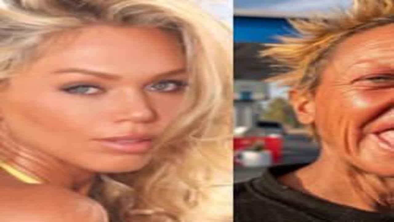 Ünlü model tanınmaz halde! Servetini kaybetti, sokaklara düştü