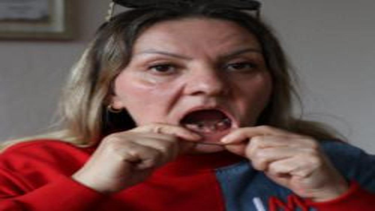 İmplant çetesinin eline düşen kadın hem 25 dişinden hem de 36 çeyrek altınından odu